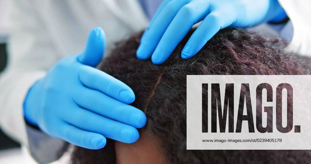 Dermatologist Checking Patient s, Dermatologist Checking Patient s Hair. Hairloss And Psoriasis Check, Dermatologist Checking Patient s Hair. Hairloss And Psoriasis Check model released, Symbolfoto , 17.02.2023,