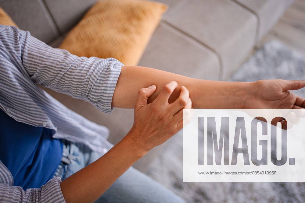 Eine Frau kratzt sich am juckenden Arm; sie leidet zu Hause an Dermatitis Close-up of female hands scratching her itchy arm, suffering from dermatitis at home (License=RF) ,model released, Symbolfoto