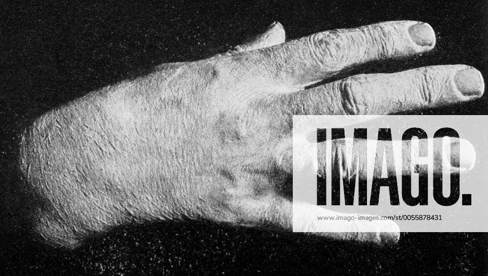 Franz Liszt s hand ; taken from a plaster cast . Hungarian composer ...