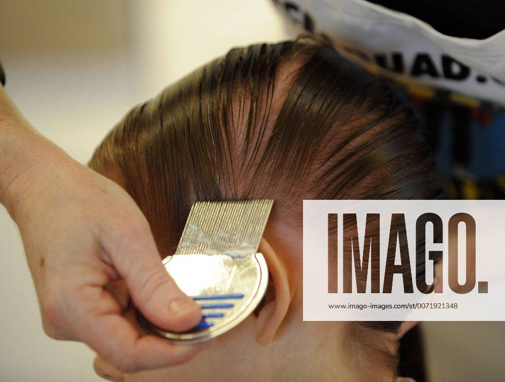 Jan. 21, 2010 Toronto, Ontario, Canada 20100129;ON;Life;L2 Lice