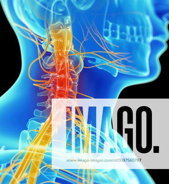 3d rendered illustration of painful neck nerves Y