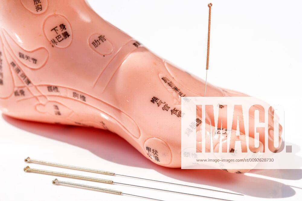 Acupuncture model foot with acupuncture needles