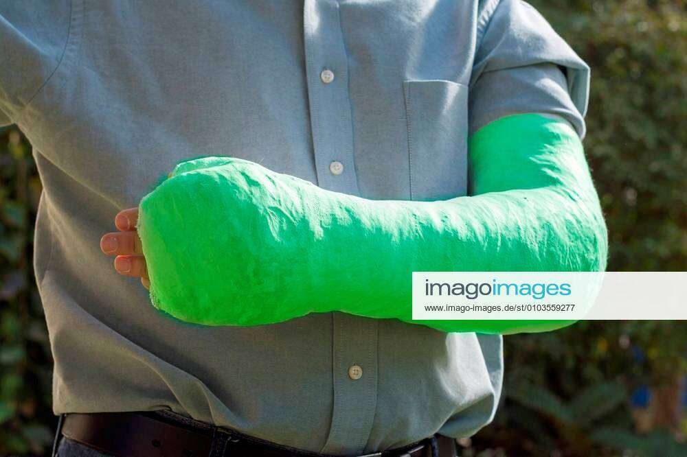 green arm cast