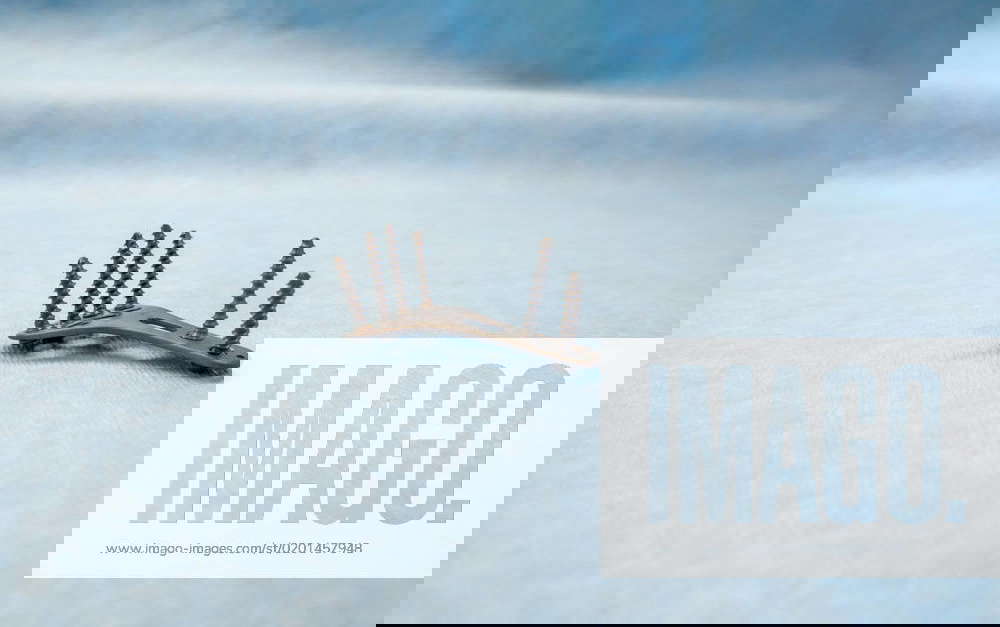 An explanted titanium plate and 4 titanium screws for the treatment of