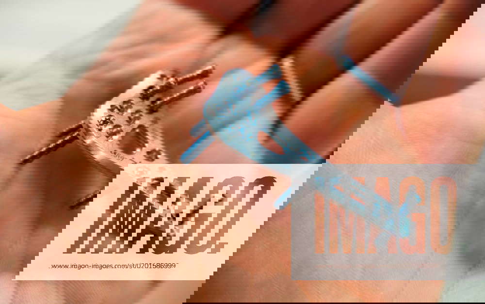 An explanted surgical blue titanium radius plate lies in one