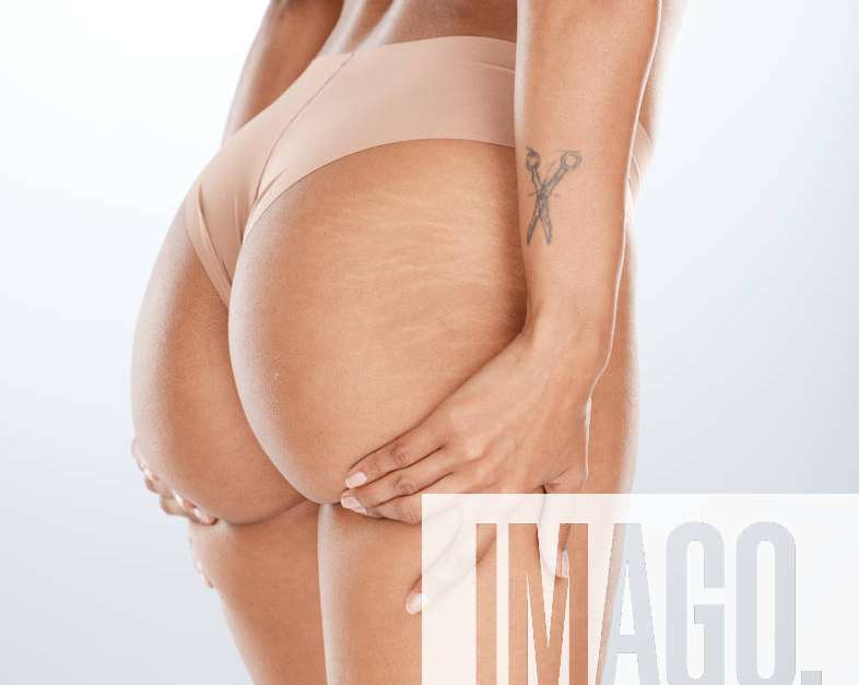 Woman underwear, hands or lifting butt in bum surgery, cellulite goal or  stretch mark solution for body liposuction. Zoom, lingerie or model panties  on isolated studio background in weight loss check