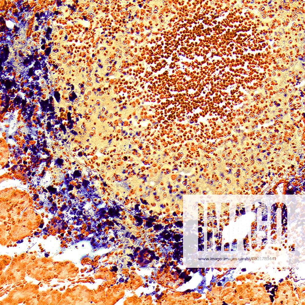 TumorTargeted Iron Oxide Nanoparticles for Imageguided