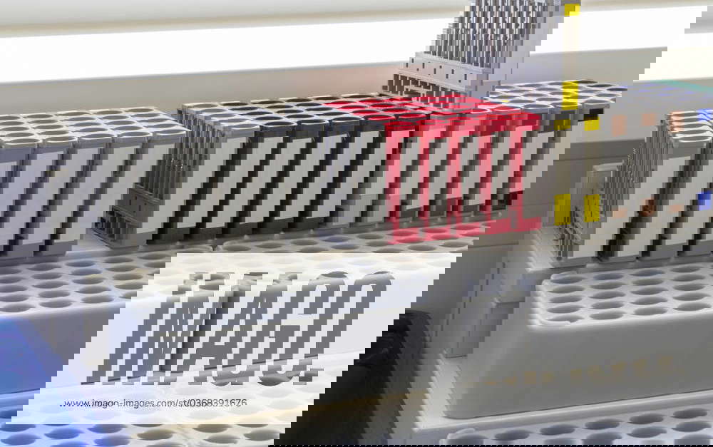 Medical sample racks closeup shot of medical sample racks