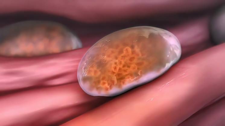 Muscles in lysosome hd 3D illustration, 47009478, medical, abstract ...